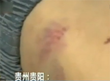 【视频】贵州五岁女童遭生父毒打，躺倒路边无法动弹