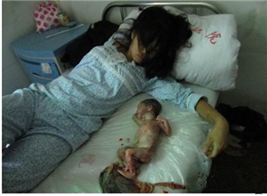 产后抑郁症有多可怕？10个月大男婴被母亲扔下高楼