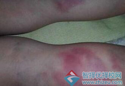 暴力教师