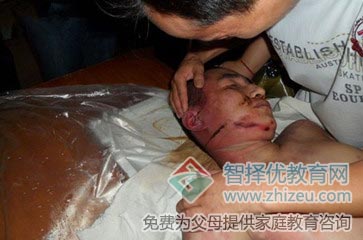 17岁少年进入湖南倍腾戒网瘾学校三天后被殴打致死