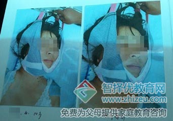 河南搏强特训学校两名少女被过度体罚致死g