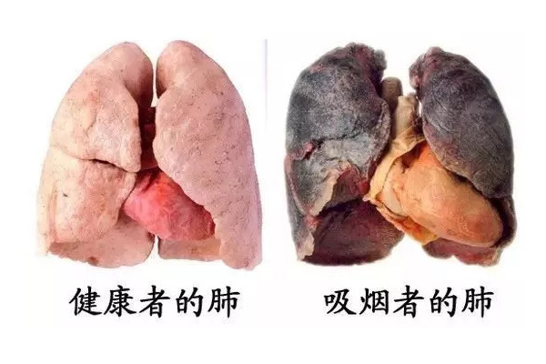 初中生男孩子抽烟怎么办？.jpg